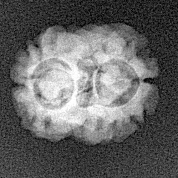 2 Mukhi Rudraksha 17.6mm 1.3gm - Xray