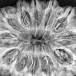 12 Mukhi Rudraksha 36.2mm 8.25gm - Xray