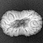 18 Mukhi Rudraksha 19.5mm 1.61gm - Xray