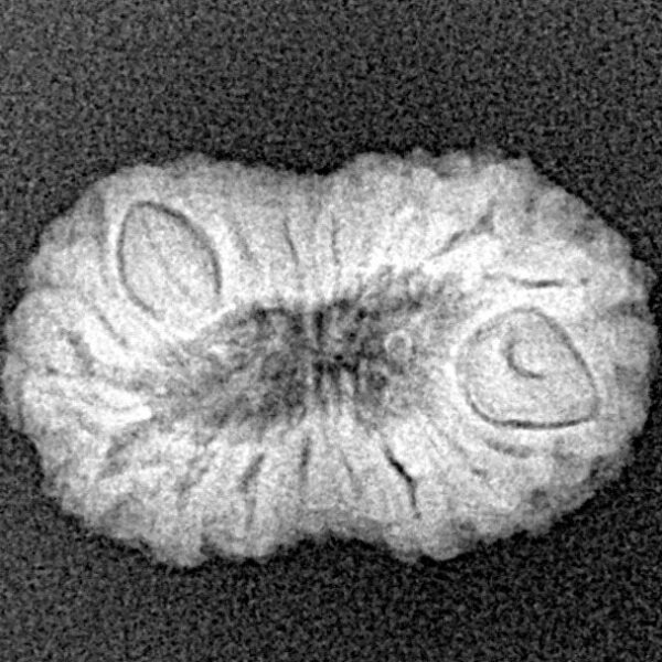 18 Mukhi Rudraksha 19.5mm 1.61gm - Xray