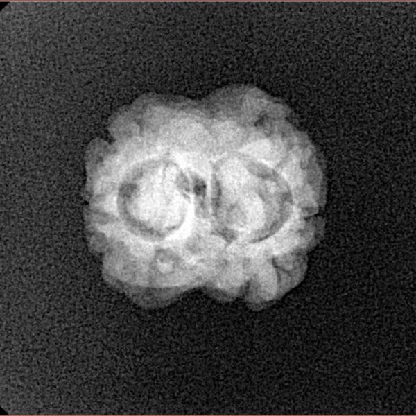 2 Mukhi Rudraksha 20.3mm 1.78gm - Xray