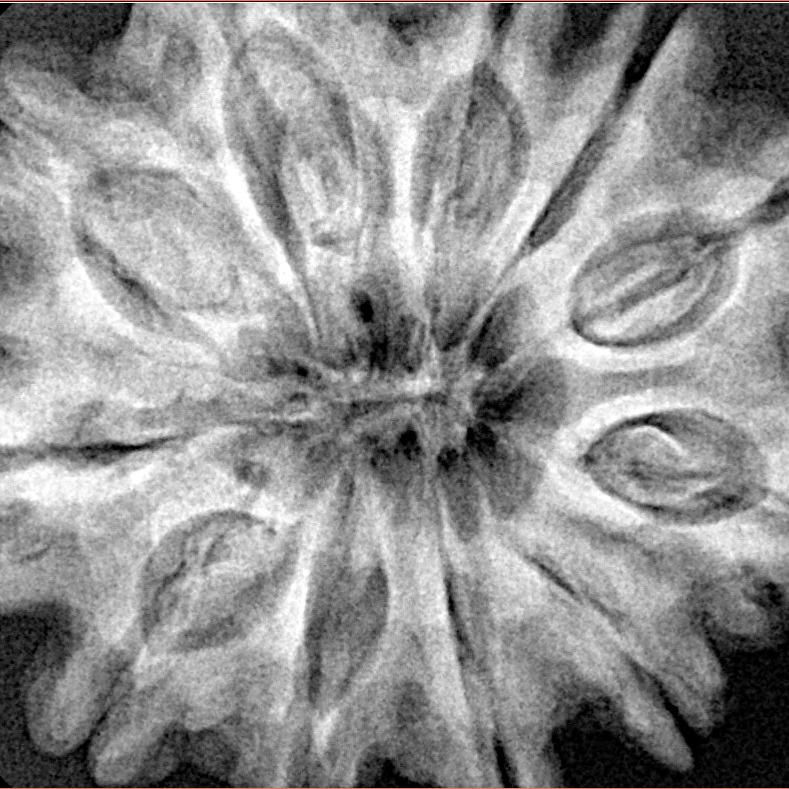 11 Mukhi Rudraksha 32.8mm 7.94gm - Xray