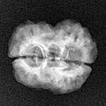 2 Mukhi Rudraksha 22.2mm 1.79gm - Xray