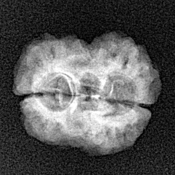 2 Mukhi Rudraksha 22.2mm 1.79gm - Xray