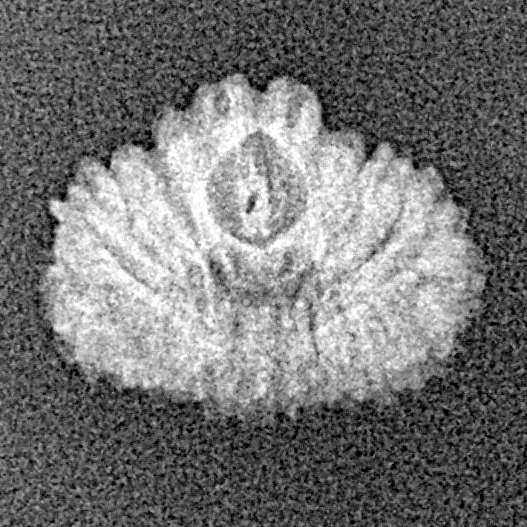 21 Mukhi Rudraksha 14.5mm 0.63gm - Xray