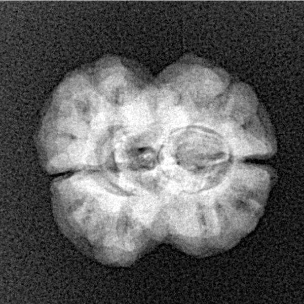 2 Mukhi Rudraksha 22.2mm 2.22gm - Xray