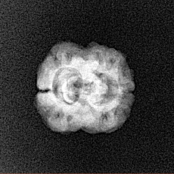 2 Mukhi Rudraksha 20.3mm 1.51gm - Xray