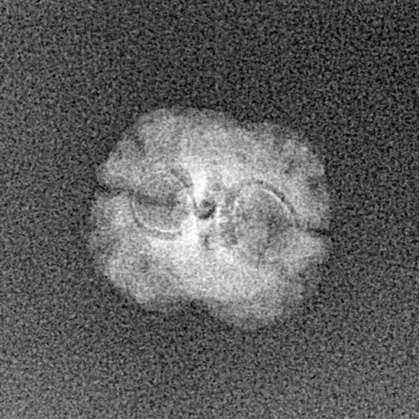 2 Mukhi Rudraksha 18.4mm 0.48gm - Xray