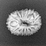 15 Mukhi Rudraksha 18.1mm 1.38gm - Xray