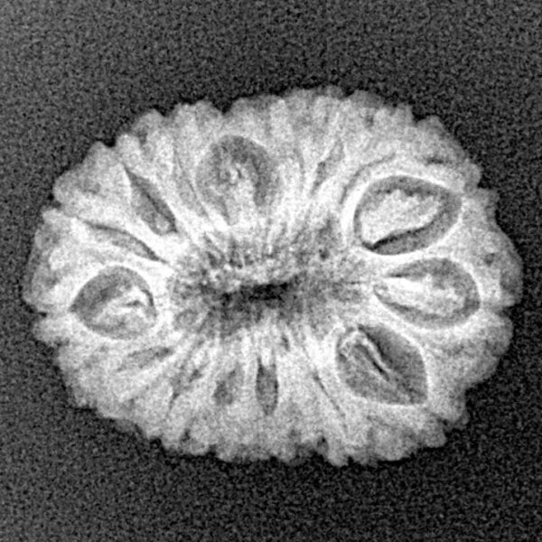 16 Mukhi Rudraksha 21.1mm 2.09gm - Xray