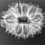12 Mukhi Rudraksha 25.1mm 2.68gm - Xray