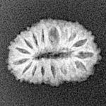 17 Mukhi Rudraksha 16.6mm 1.1gm - Xray