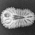 18 Mukhi Rudraksha 19.7mm 1.36gm - Xray