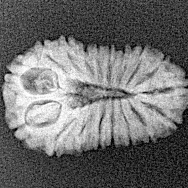 18 Mukhi Rudraksha 19.7mm 1.36gm - Xray