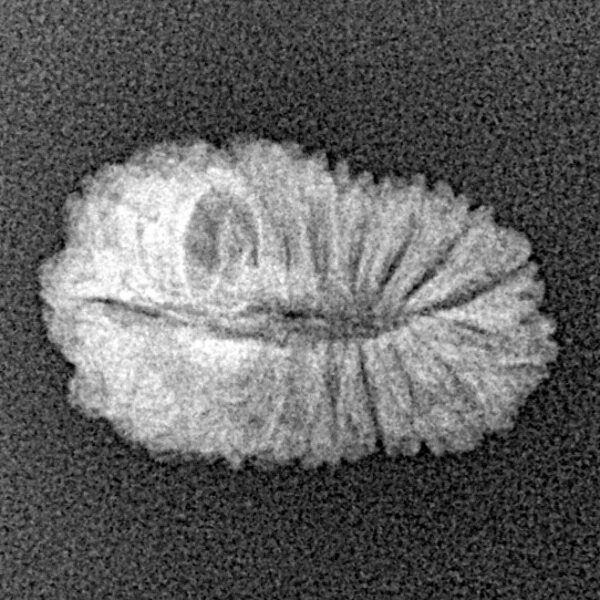 20 Mukhi Rudraksha 18.7mm 1.08gm - Xray