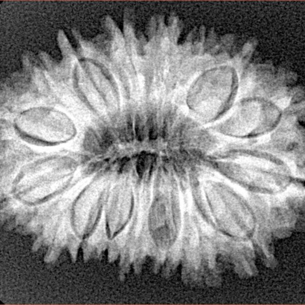 17 Mukhi Rudraksha 29.3mm 4.61gm - Xray