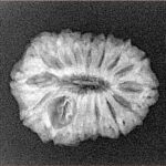 15 Mukhi Rudraksha 22.7mm 2.32gm - Xray