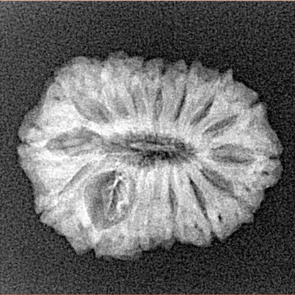 15 Mukhi Rudraksha 22.7mm 2.32gm - Xray