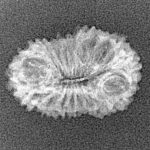 21 Mukhi Rudraksha 21.4mm 1gm - Xray