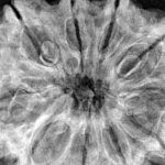 10 Mukhi Rudraksha 36mm 8.49gm - Xray