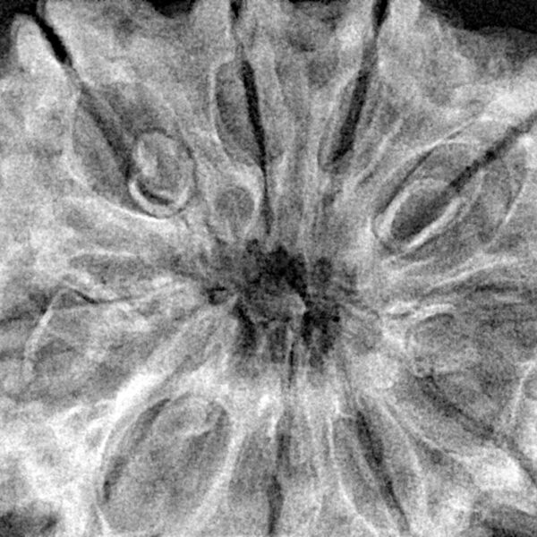 10 Mukhi Rudraksha 36mm 8.49gm - Xray