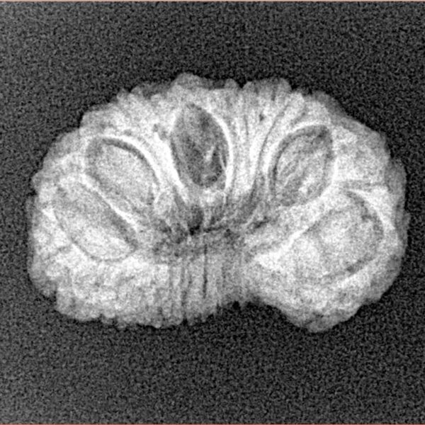 15 Mukhi Rudraksha 22.8mm 2.23gm - Xray
