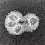 15 Mukhi Rudraksha 20.2mm 1.19gm - Xray
