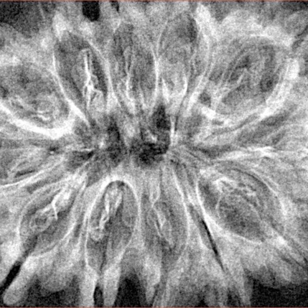 12 Mukhi Rudraksha 36.7mm 7gm - Xray