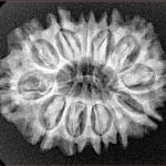 12 Mukhi Rudraksha 27.9mm 4.45gm - Xray