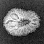 15 Mukhi Rudraksha 20.4mm 1.74gm - Xray