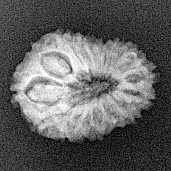 15 Mukhi Rudraksha 20.4mm 1.74gm - Xray