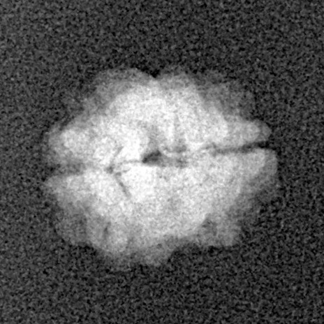 2 Mukhi Rudraksha 14.1mm 0.68gm - Xray