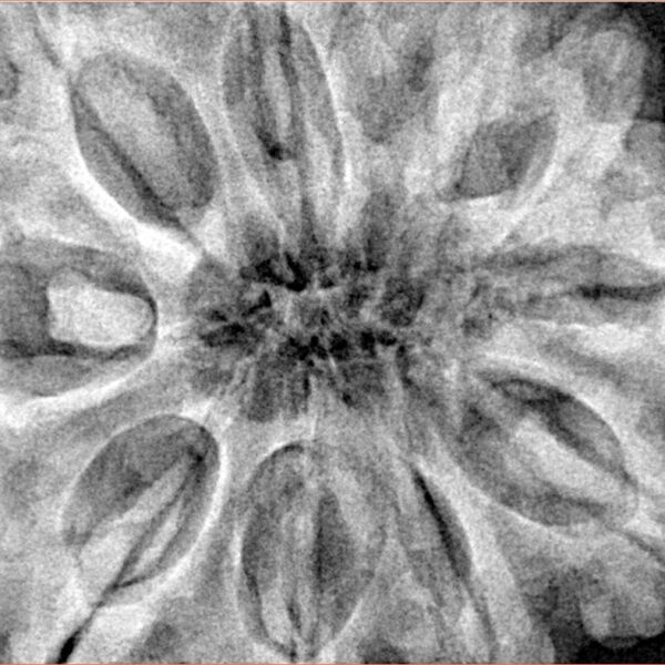 10 Mukhi Rudraksha 36.2mm 11.2gm - Xray