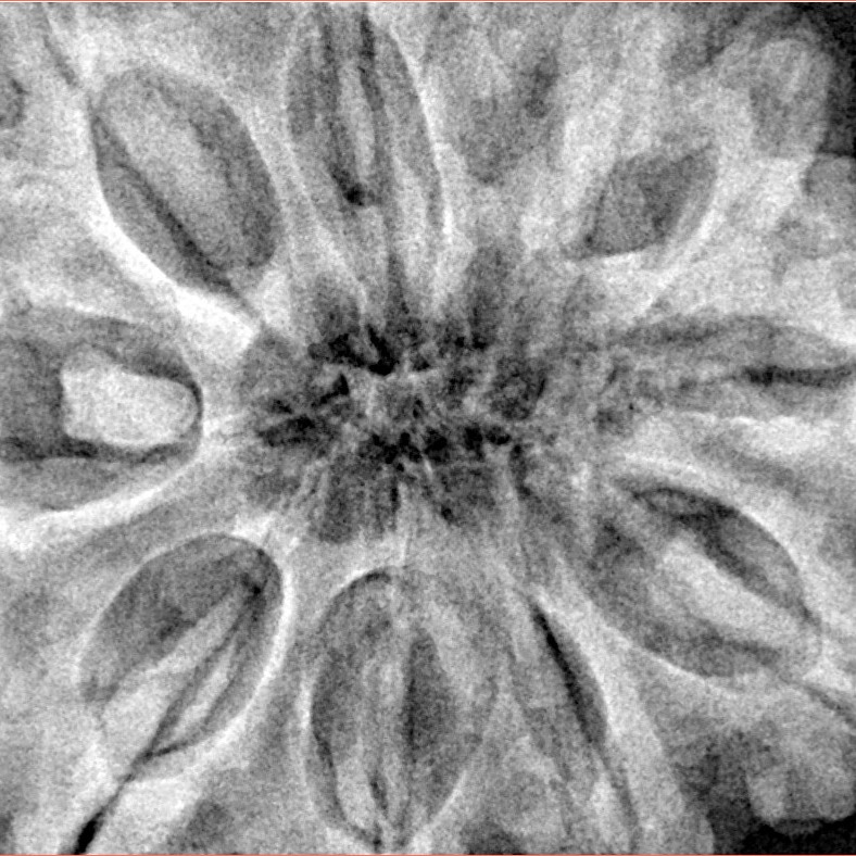 10 Mukhi Rudraksha 36.2mm 11.2gm - Xray