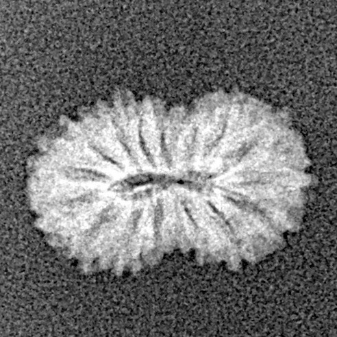 16 Mukhi Rudraksha 13.8mm 0.53gm - Xray