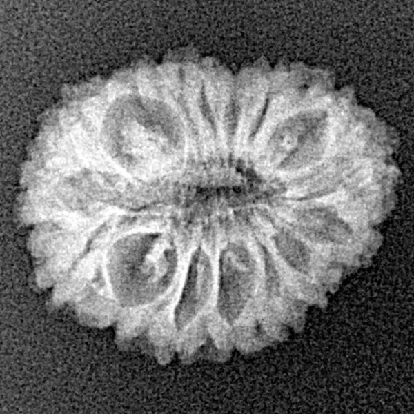 16 Mukhi Rudraksha 20.1mm 1.66gm - Xray
