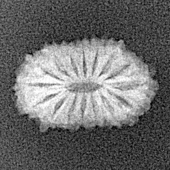 16 Mukhi Rudraksha 15.9mm 0.84gm - Xray