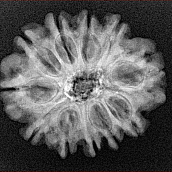 11 Mukhi Rudraksha 24.4mm 3.84gm - Xray