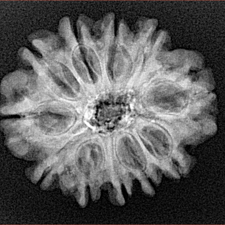 11 Mukhi Rudraksha 24.4mm 3.84gm - Xray