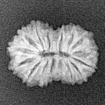 16 Mukhi Rudraksha 17.4mm 1.1gm - Xray