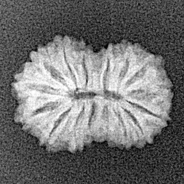 16 Mukhi Rudraksha 17.4mm 1.1gm - Xray