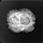 2 Mukhi Rudraksha 24.3mm 2.49gm - Xray