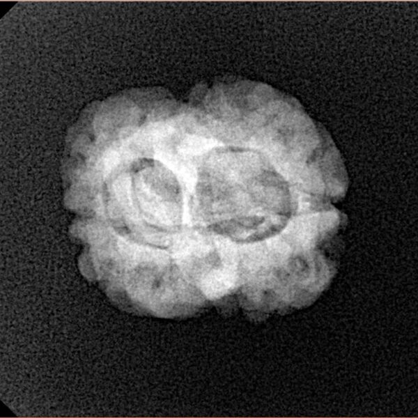 2 Mukhi Rudraksha 24.3mm 2.49gm - Xray