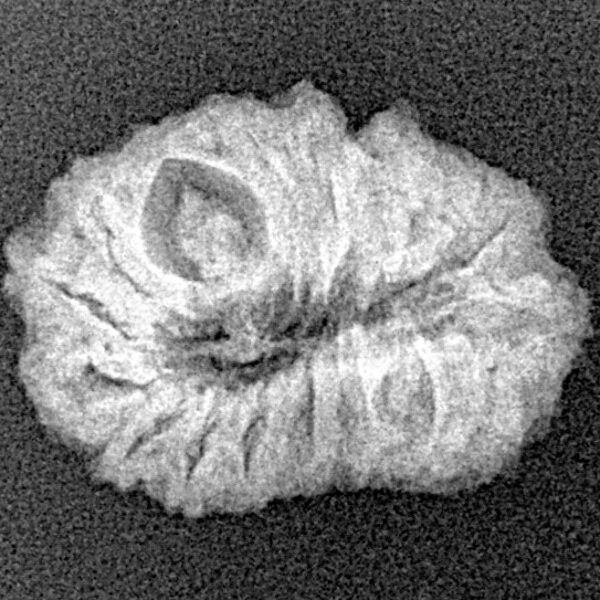 18 Mukhi Rudraksha 20.9mm 1.81gm - Xray