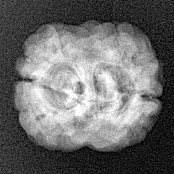 2 Mukhi Rudraksha 22.5mm 2.26gm - Xray