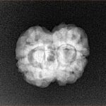2 Mukhi Rudraksha 24.2mm 2.7gm - Xray