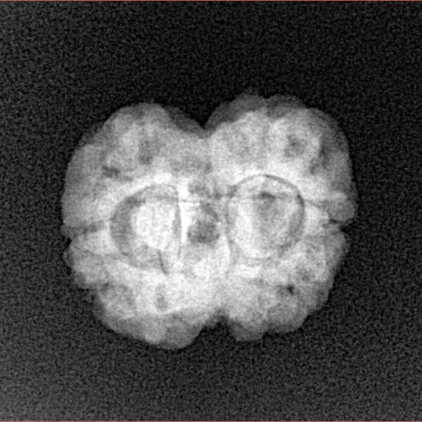 2 Mukhi Rudraksha 24.2mm 2.7gm - Xray