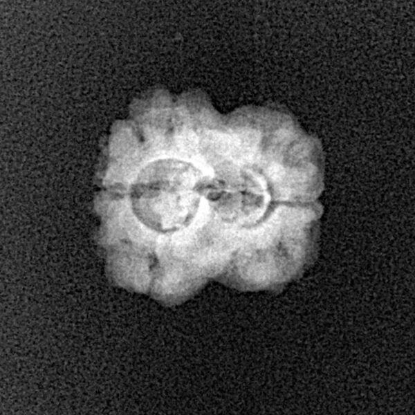 2 Mukhi Rudraksha 20.1mm 1.36gm - Xray