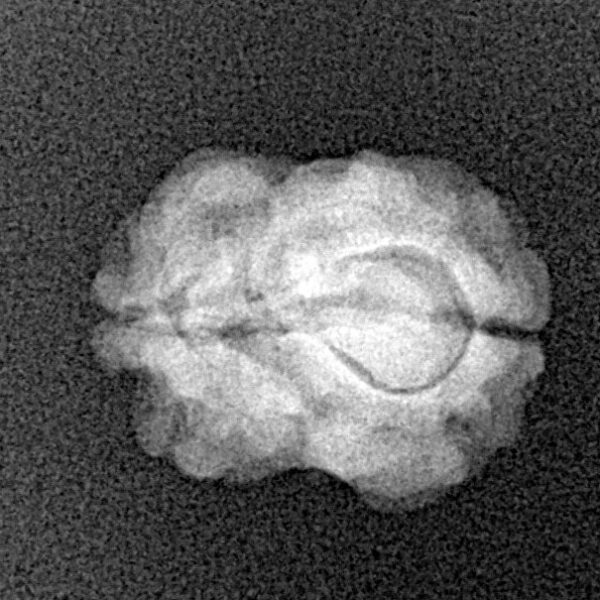 2 Mukhi Rudraksha 15.8mm 1.25gm - Xray