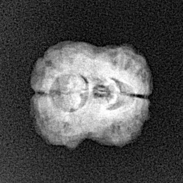 2 Mukhi Rudraksha 22.9mm 1.81gm - Xray